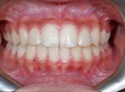 soin-dorthodontie-clinique-dentaire-st-charles-specialistes-en-orthodontie-pierrefond