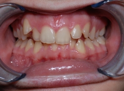 service-dorthodontie-clinique-dentaire-st-charles-experts-en-orthodontie-pierrefond